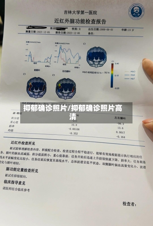 抑郁确诊照片/抑郁确诊照片高清-第2张图片
