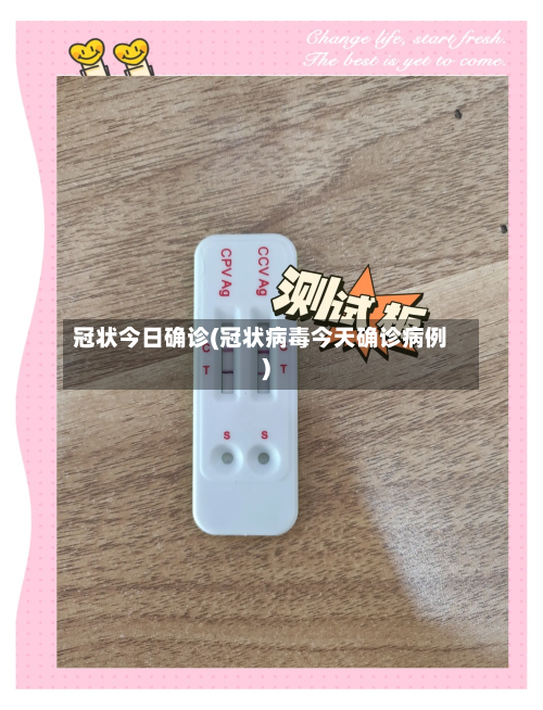 冠状今日确诊(冠状病毒今天确诊病例)-第3张图片