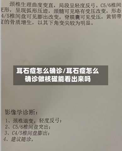 耳石症怎么确诊/耳石症怎么确诊做核磁能看出来吗