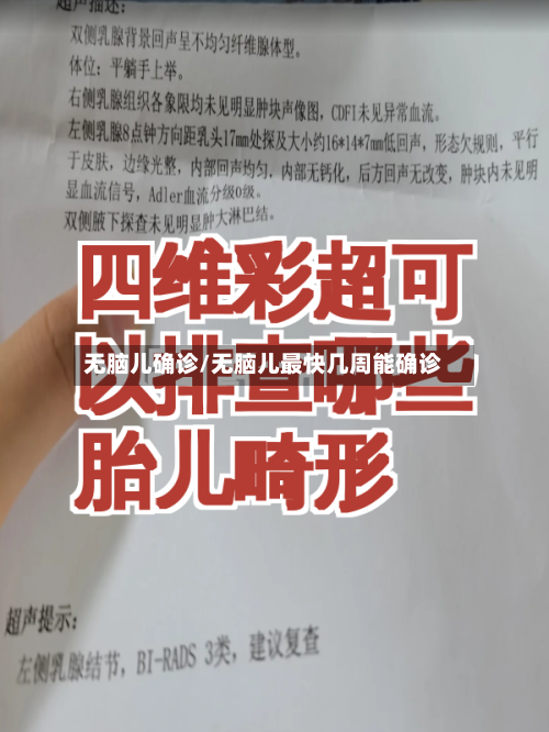 无脑儿确诊/无脑儿最快几周能确诊