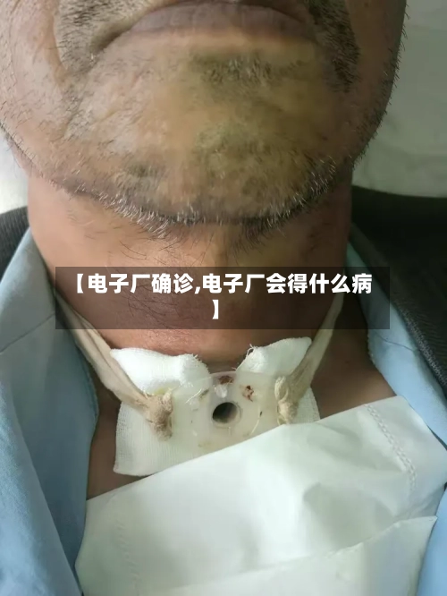 【电子厂确诊,电子厂会得什么病】