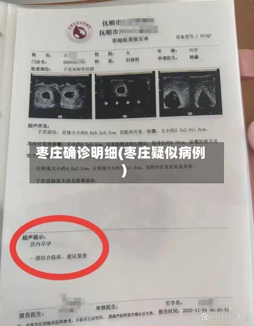 枣庄确诊明细(枣庄疑似病例)