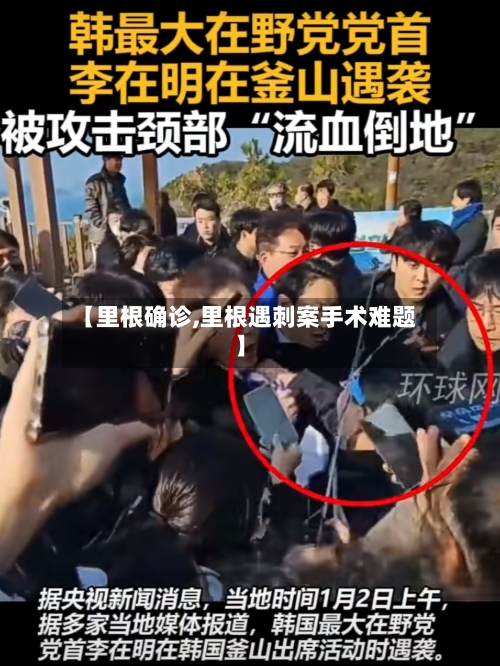 【里根确诊,里根遇刺案手术难题】-第2张图片