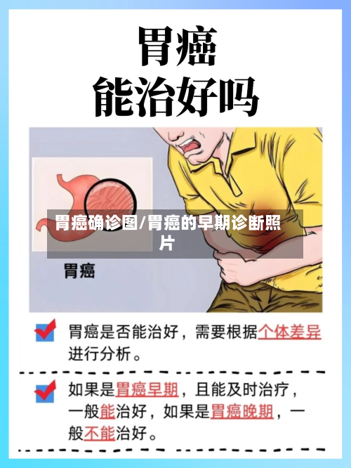 胃癌确诊图/胃癌的早期诊断照片-第2张图片