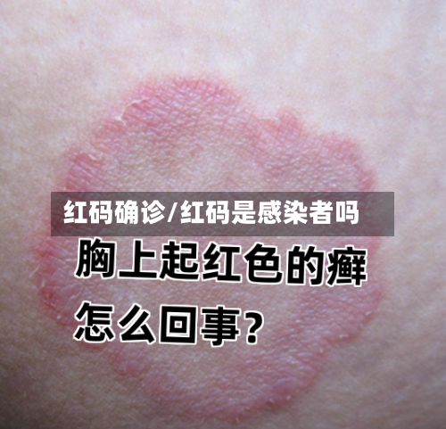 红码确诊/红码是感染者吗