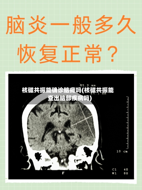 核磁共振能确诊脑瘫吗(核磁共振能查出脑部疾病吗)