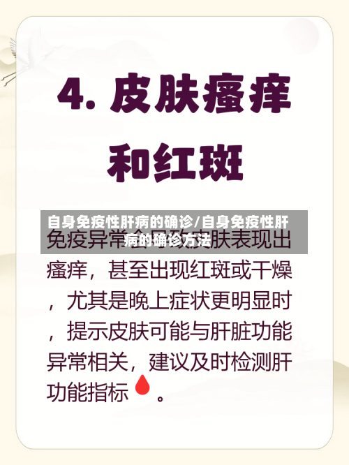 自身免疫性肝病的确诊/自身免疫性肝病的确诊方法-第2张图片