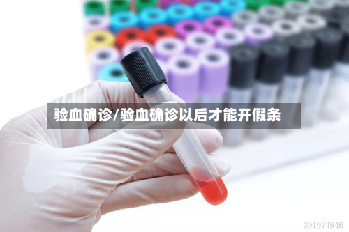 验血确诊/验血确诊以后才能开假条-第2张图片