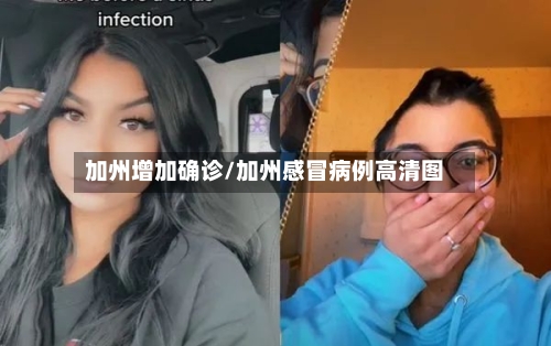 加州增加确诊/加州感冒病例高清图