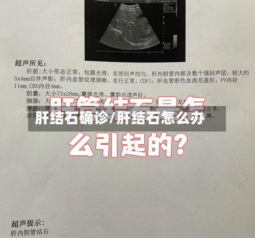 肝结石确诊/肝结石怎么办