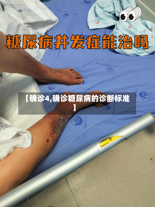 【确诊4,确诊糖尿病的诊断标准】