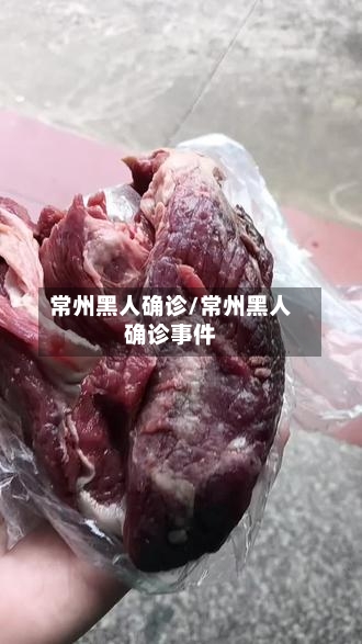 常州黑人确诊/常州黑人确诊事件-第3张图片