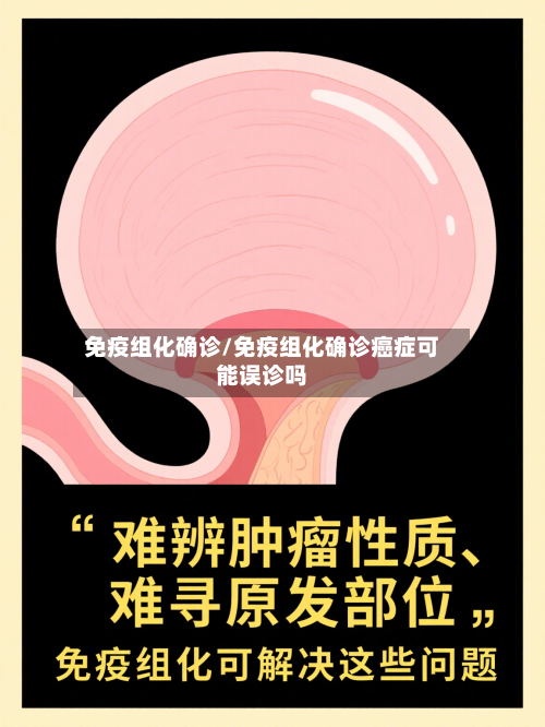 免疫组化确诊/免疫组化确诊癌症可能误诊吗-第2张图片