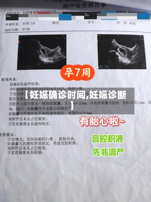 【妊娠确诊时间,妊娠诊断】-第2张图片